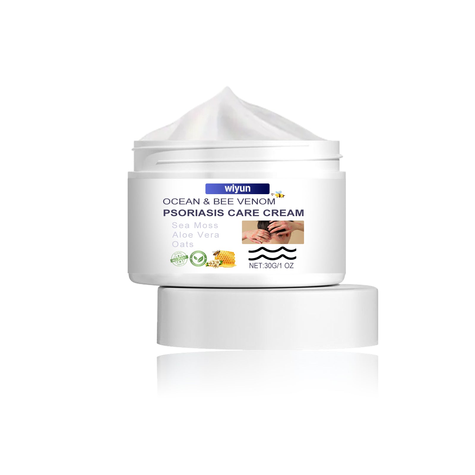 Psoriasis Care Cream